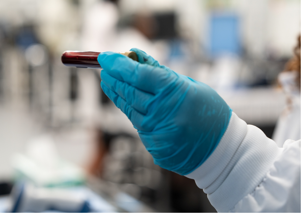 mced blood test vial